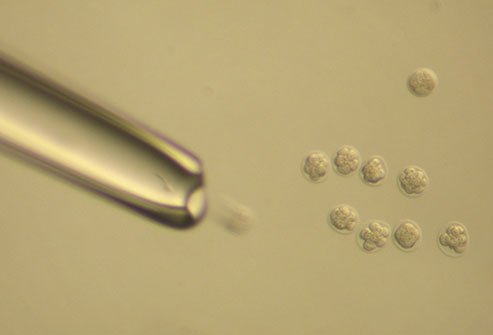Hormone imbalance is a common cause of female infertility.