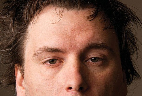 Alcohol dehydrates you, gives you a headache, and may cause nausea and vomiting. 