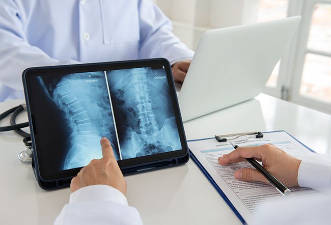 Is Bulging Disc the Same as Herniated Disc Is Bulging Disc the Same as Herniated Disc