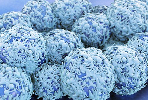 The actual cause of developing cervical cancer is still being researched. However, studies suggest that cervical cancer may be caused by infection with certain strains of human papillomavirus (HPV).