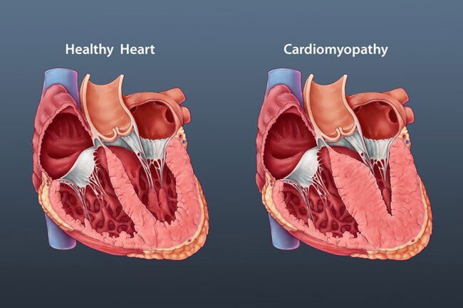 Doctors have noticed a number of heart issues in people with COVID-19, especially in those who are seriously ill. 