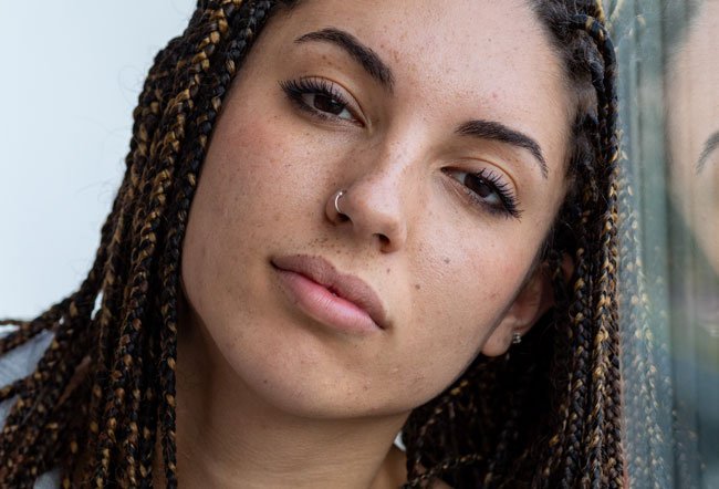 keloid nose piercing keloid nose piercing