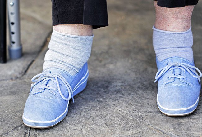Your swollen feet and ankle treatment will most likely be for the condition that is causing the swelling instead of the swelling itself. Your swollen feet and ankle treatment will most likely be for the condition that is causing the swelling instead of the swelling itself.