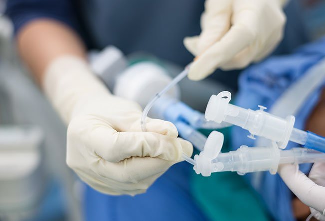 Double-lumen tubes are placed with the help of anesthesia in a series of steps.