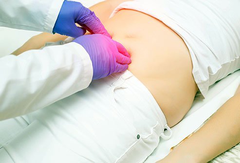 Surgery is the only definitive way to treat a hernia. Surgery is the only definitive way to treat a hernia.