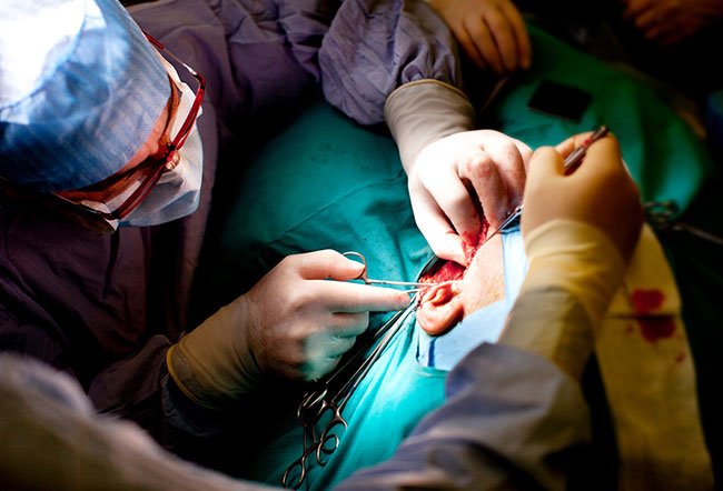 For many people with parotid gland tumors, parotidectomy is necessary.