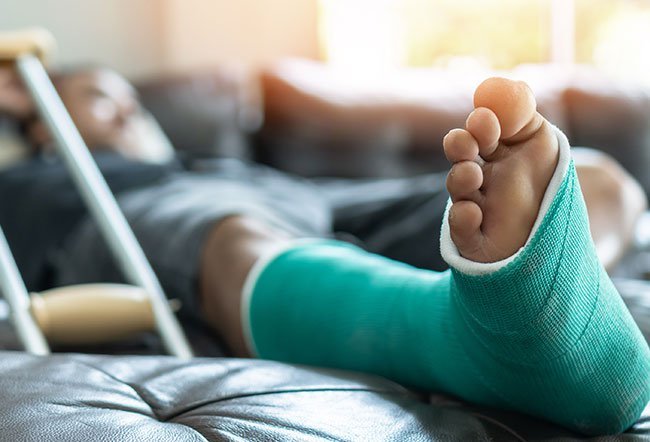 tibial plateau fracture tibial plateau fracture