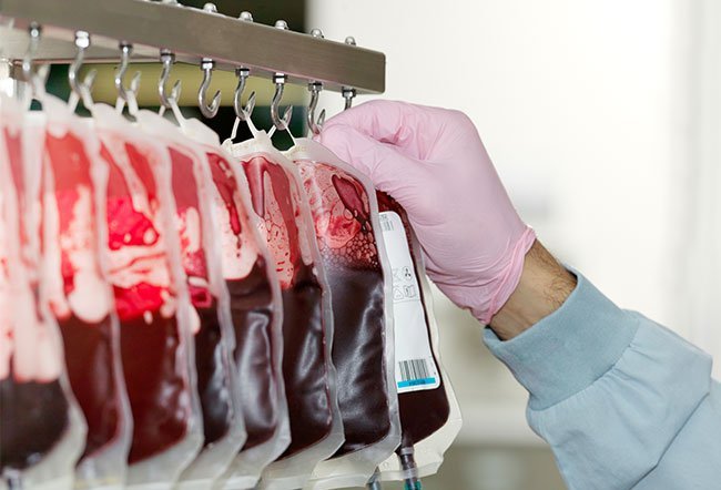 how many pints of blood are there in the human body how many pints of blood are there in the human body
