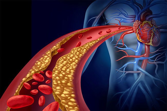 Research shows people with type O blood have a lower risk of coronary heart disease.