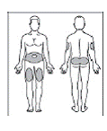 Injection site - Illustration