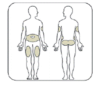 Choose your injection site - Illustration