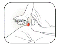 Insert the Needle into your skin - Illustration
