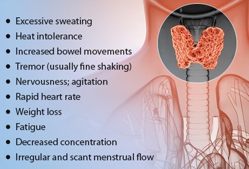 When hyperthyroidism is mild, patients may not experience any symptoms.