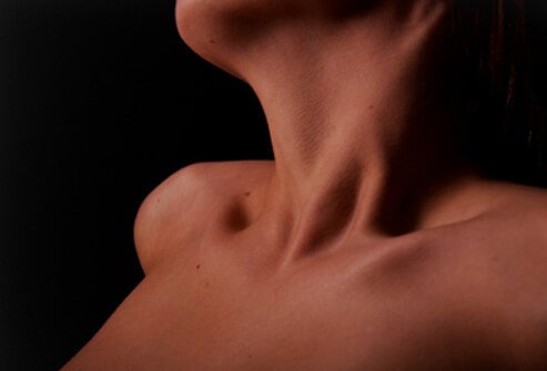 Hyperthyroidism is a medical condition that results from an excess of thyroid hormone in the blood.