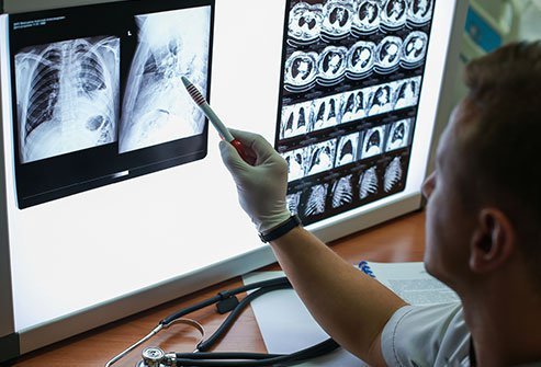 Hypoxia is a state of insufficient oxygen supply for normal life functions, and hypoxemia is a state of low arterial oxygen supply.