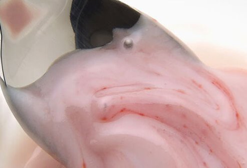 Yogurt is rich in probiotics and vitamins to help boost immunity.