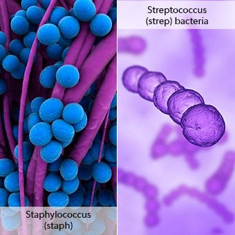 Illustrations of Staphylococcus (staph) and Streptococcus (strep) bacteria.