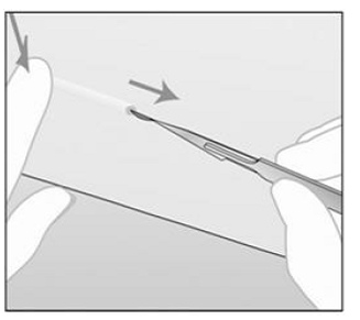 The implant is now in its final subdermal position, and the needle is locked inside the body of the applicator - Illustration