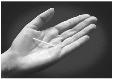 If the tip of the
implant does not become visible in the incision, insert a forceps (preferably
curved mosquito forceps, with the tips pointed up) superficially into the
incision - Illustration