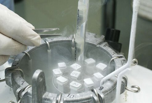 IUI can also be performed using sperm from a donor if the male partner has a low number of healthy sperms. 