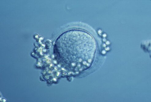 Women who have poor egg quality, are older, or who have not had success with previous IVF cycles, may choose to consider IVF with donor eggs and her partner's sperm. 