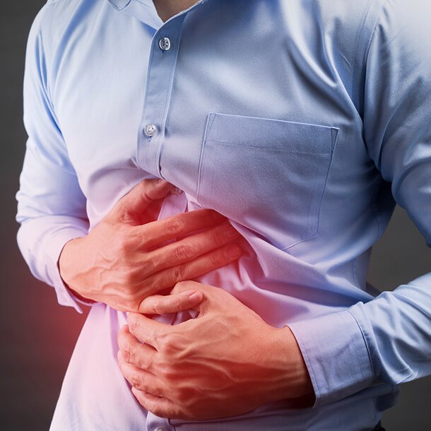 Inflammatory Bowel Disease (IBD)