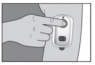 IONSYS dosing button - Illustration