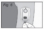 Remove IONSYS from the patient - Illustration