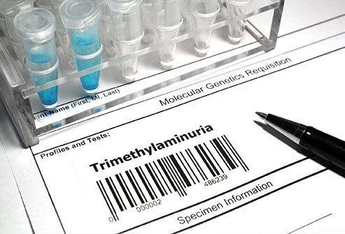 Excess trimethylamine is the cause of the fishy odor or rotten fish odor.