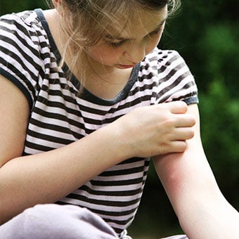 Scratching itchy skin can cause infections and complications.