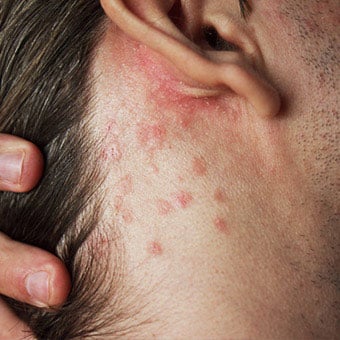An itchy rash could be an allergy or a more serious problem requiring medical attention.