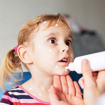 Medications and lotions are used to treat itchy skin and the underlying causes of itching.