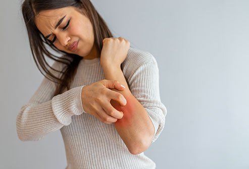 Pruritus, or itching, may be caused by a variety of conditions.