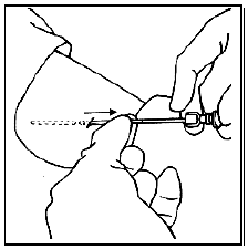 Withdraw the trocar to the mark closest to the trocar tip - Illustration