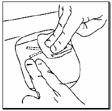 A sterile gauze may be used to apply pressure briefly - Illustration