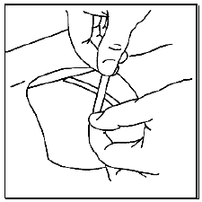 Press the edges of the incision together, and close the incision with a skin closure - Illustration