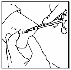 Push each implant gently towards the incision with the fingers - Illustration