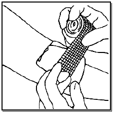 Incision is closed and bandaged - Illustration