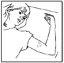 Have the patient lie on her back on the examination table - Illustration