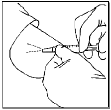 Anesthetize the insertion area - Illustration