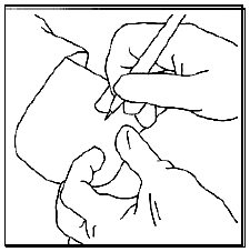 Use the scalpel to make a small incision - Illustration