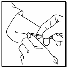 Insert the tip of the trocar beneath the skin at a shallow angle - Illustration