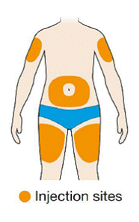 Twist or pull off the orange cap - Illustration