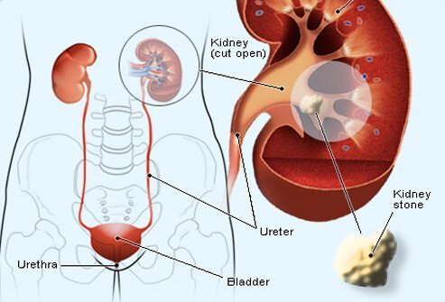 The kidneys regulate levels of fluid, minerals, salts, and other substances in your body. 