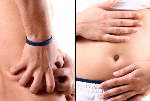 any kidney stones are painless until they travel from the kidney, down the ureter, and into the bladder. 