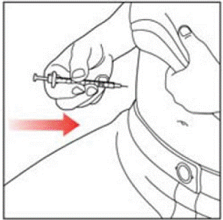 Insert the Needle into your skin - Illustration