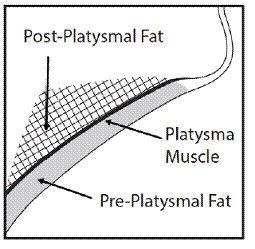 Sagittal View of Platysma Area - Illustration