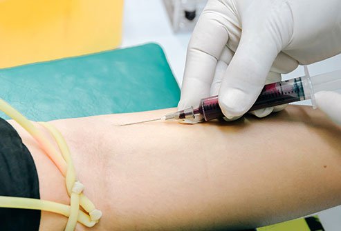To choose the best treatment, you need to learn as much as possible about the cancer.
