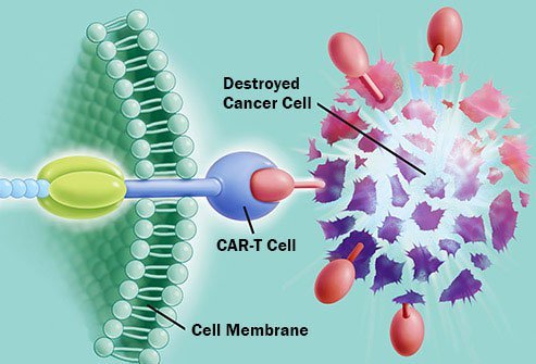 CAR T is a new kind of customized immunotherapy.