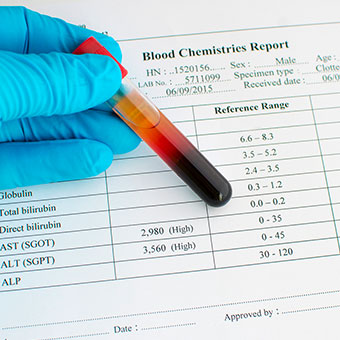 Other symptoms of increased liver enzymes include jaundice, bruising, confusion, and an enlarged spleen.